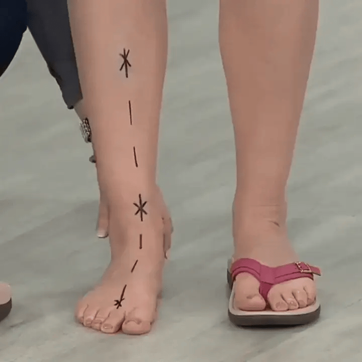 Wilma | Orthopedic Summer Sandals